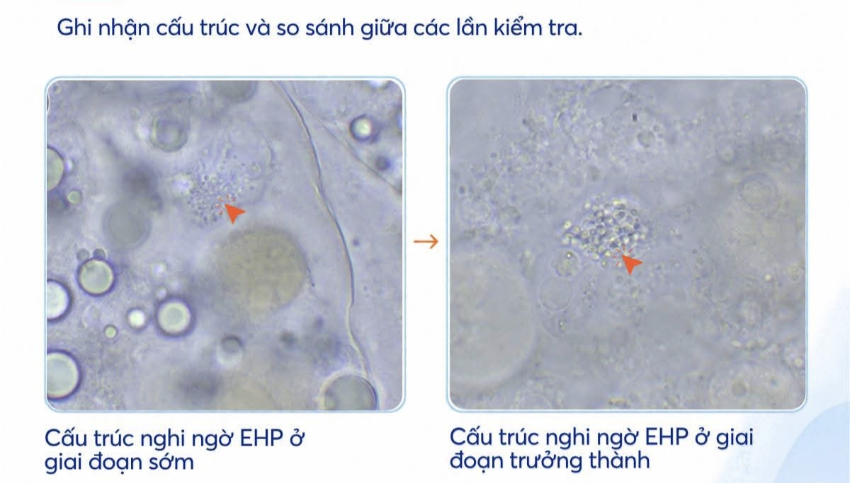 Hình ảnh kính hiển vi so sánh cấu trúc nghi ngờ EHP ở giai đoạn sớm và giai đoạn trưởng thành.