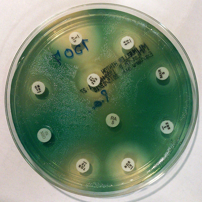 vi khuẩn Pseudomonas aeruginosa