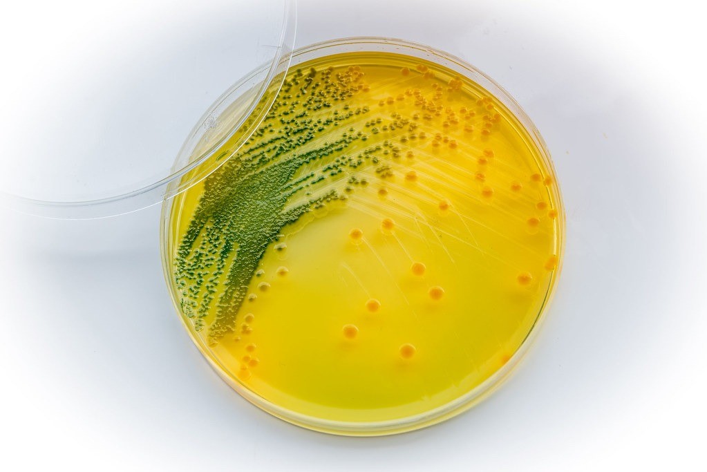 vi khuẩn Vibrio