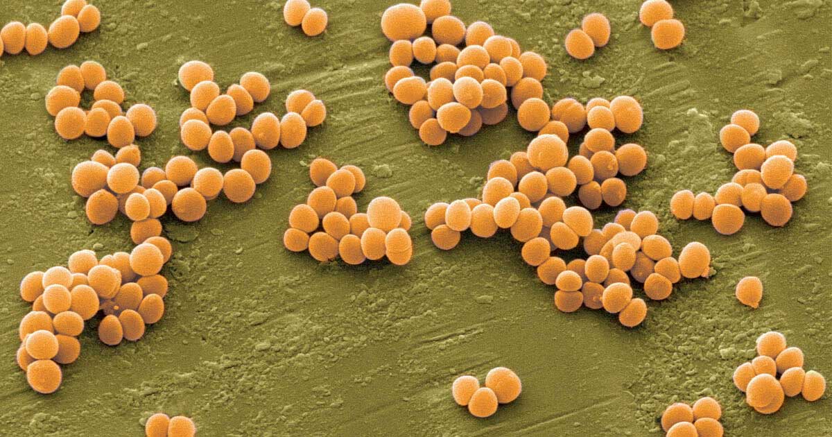 Staphylococcus aureus