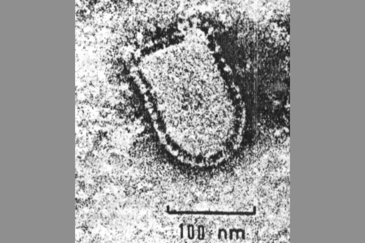 Rhabdovirus carpio