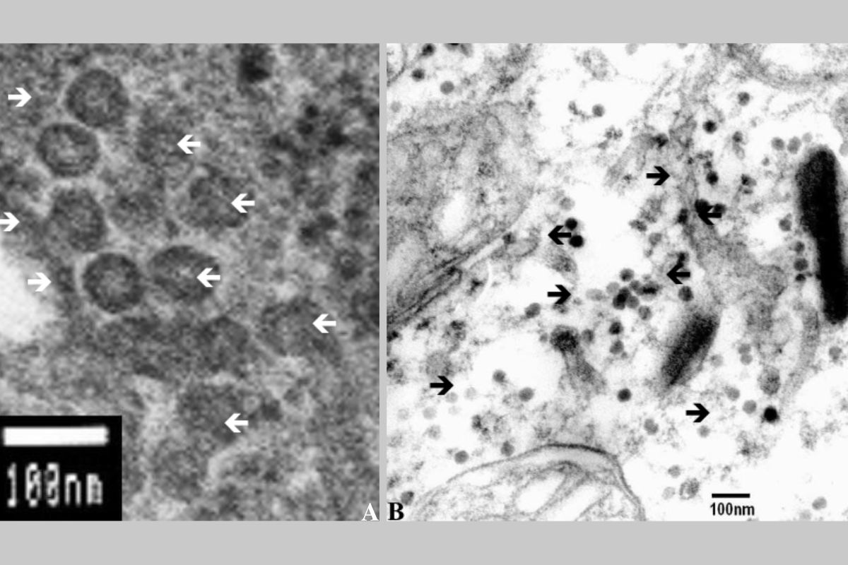 Thể virus