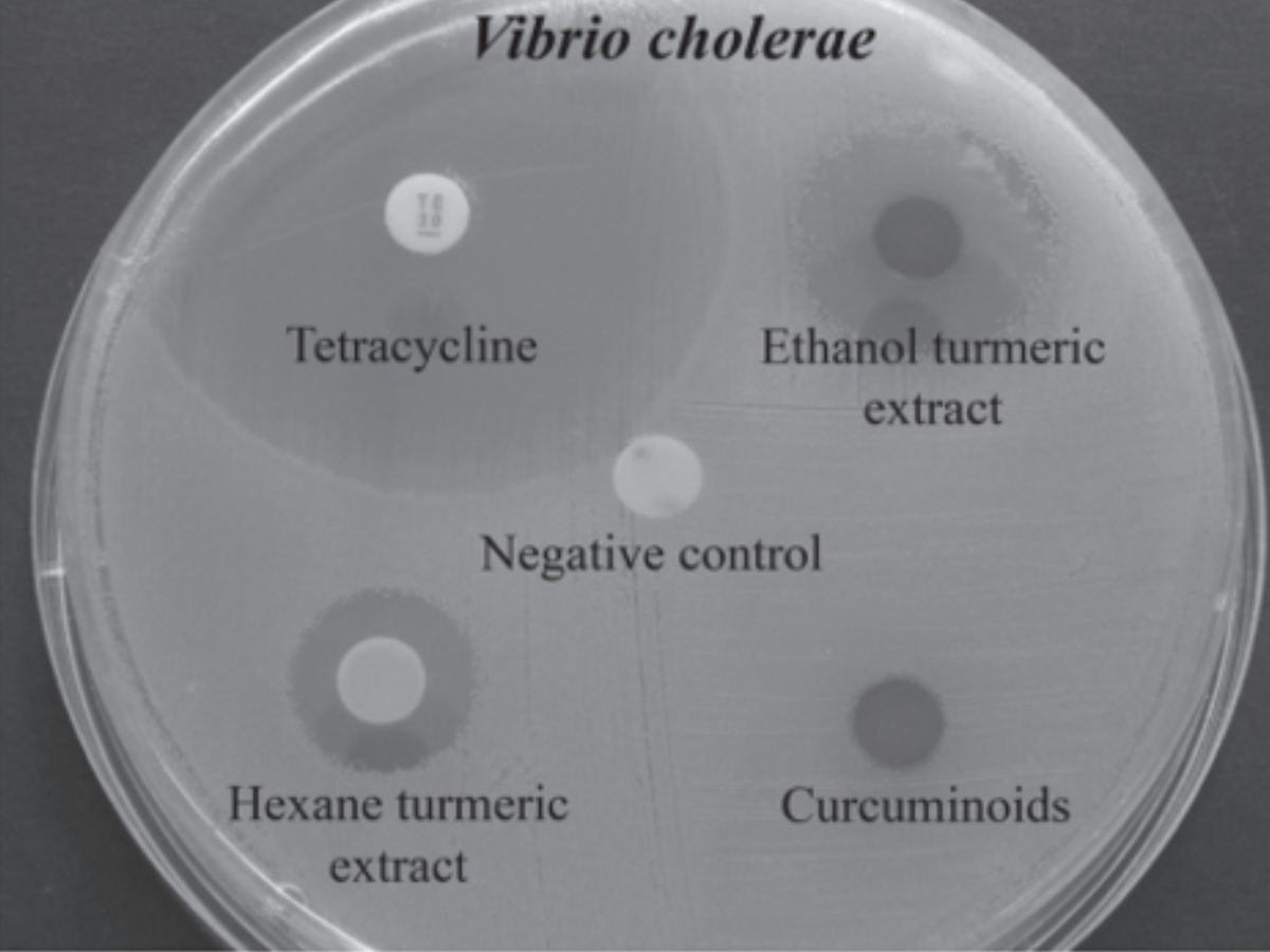 Vibrio Cholerae