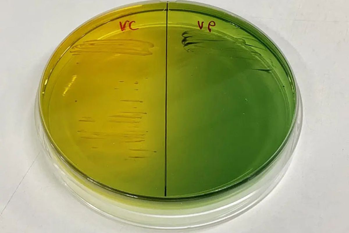 Vi khuẩn Vibrio