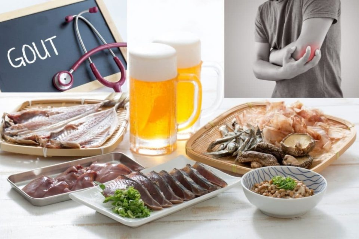Mối liên hệ giữa hải sản, purin và bệnh gút