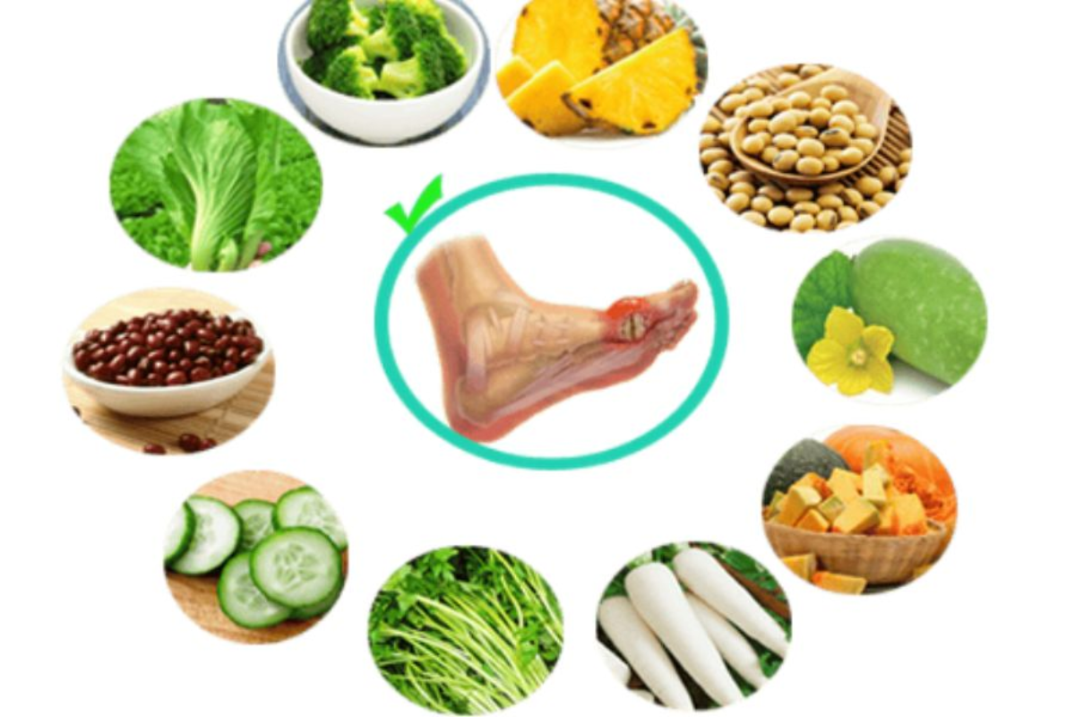 Chế độ ăn uống đầy đủ dinh dưỡng dành cho người bệnh gout
