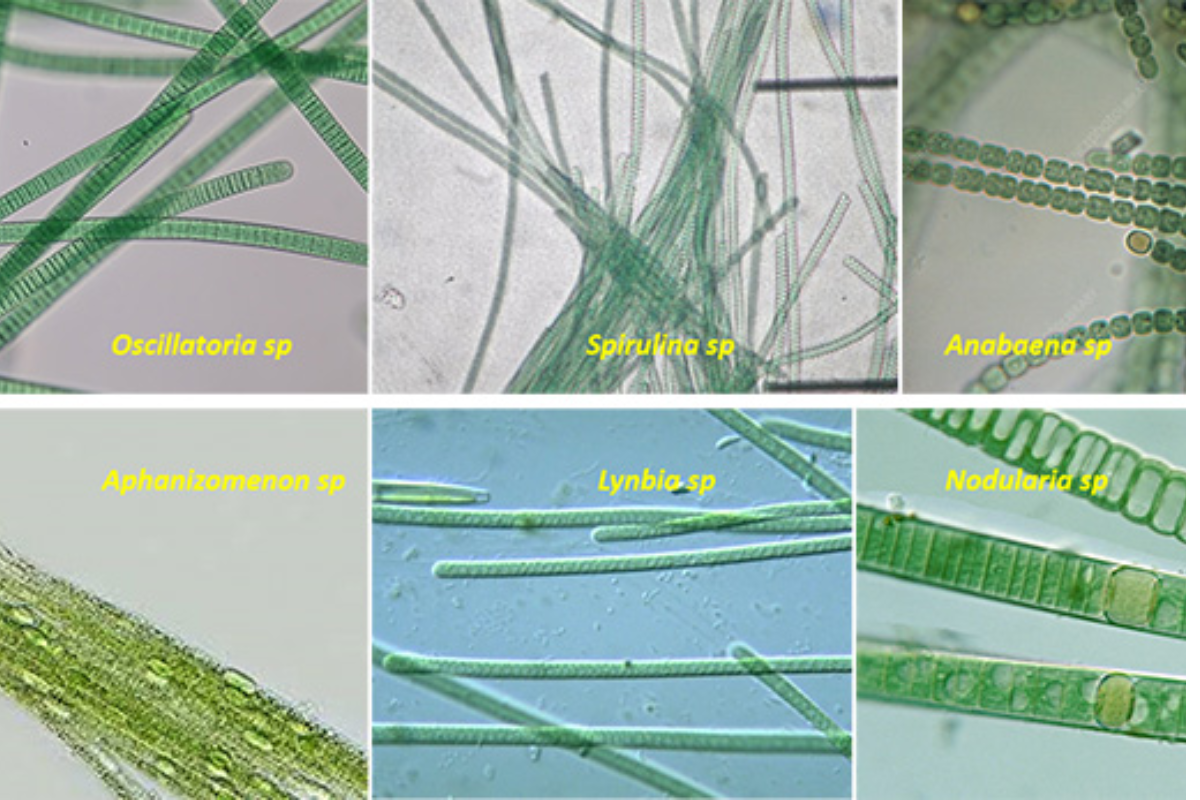 Tảo lam dạng sợi