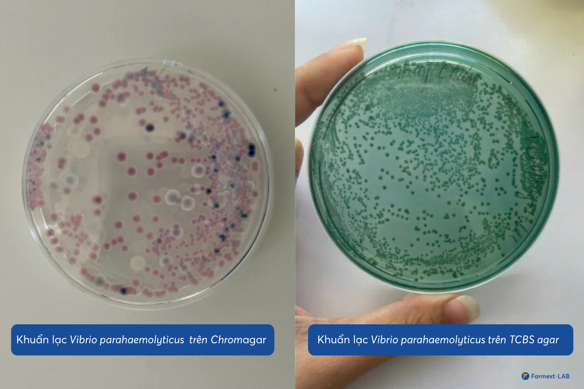 Khuẩn lạc Vibrio parahaemolyticus trên ChromAgar có màu tím và trên TCBS agar có màu xanh lục