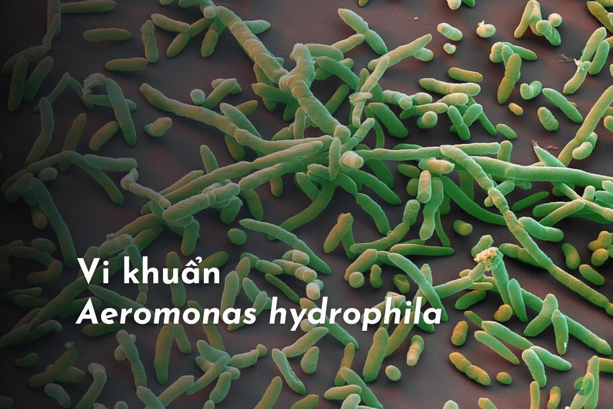 Vi khuẩn Aeromonas