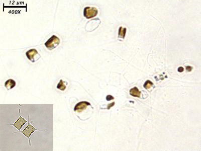  thức ăn Copepod Oithona sp, Copepod Oithona sp trong nuôi trồng thủy sản, thức ăn tôm giống, tảo cho copepod, Chaetoceros calcitrans 