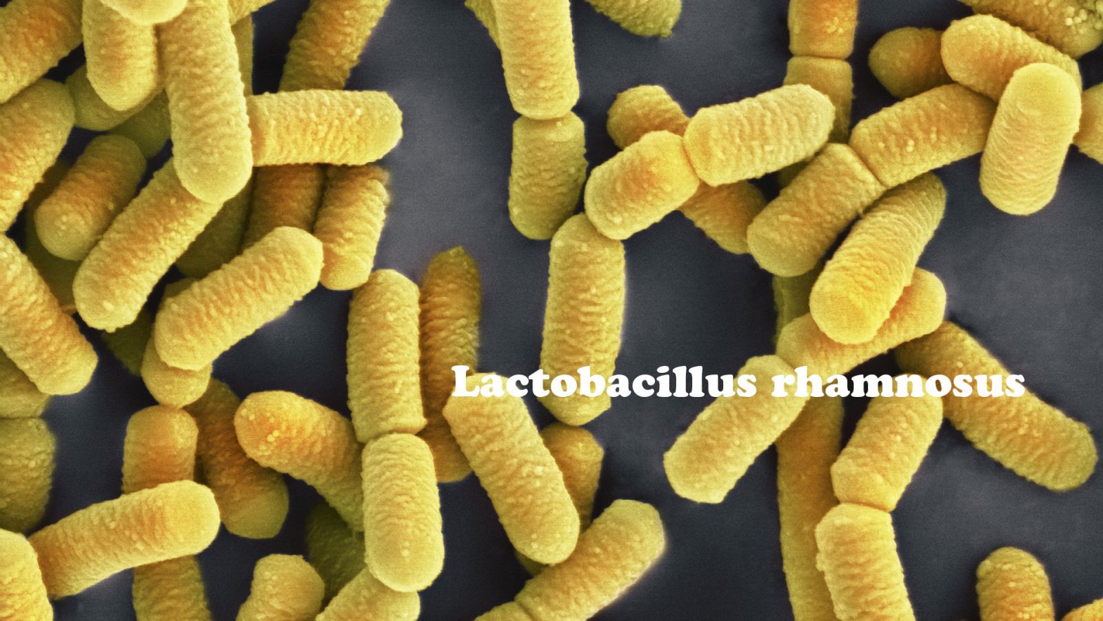 tăng trưởng cá tráp, probiotics, vai trò probiotic với cá, Lactobacillus rhamnosus