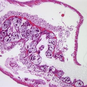 cá bệnh Myxobolus cerebralis, Myxobolus cerebralis, 6 bệnh ký sinh trùng nguy hiểm trên cá