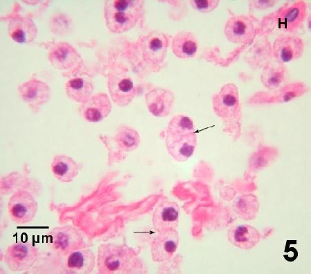 bệnh trên cua, bệnh do ký sinh trùng trên cua, bệnh do hematodinium trên cua