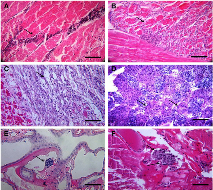 bệnh hoại tử cơ trên tôm thẻ do IMNV, bệnh hoại tử cơ do IMNV, bệnh cơ trên tôm