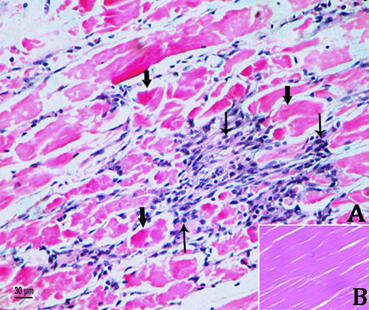 hoại tử cơ do vi khuẩn, hoại tử cơ do PvNV, PvnV in shrimp, bệnh cơ trên tôm