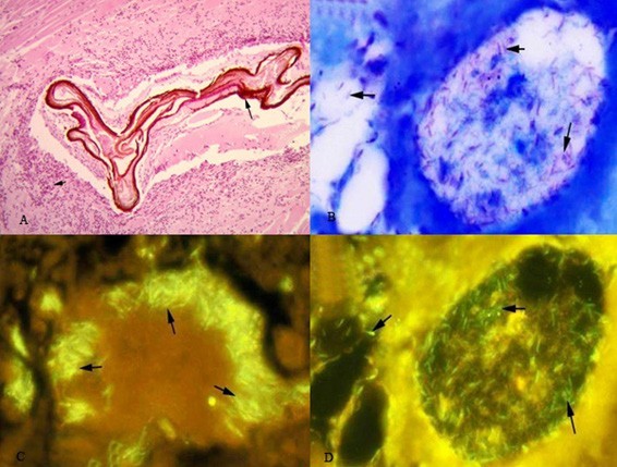 bệnh Mycobacteriosis trên tôm, bệnh tôm, bệnh tôm thẻ chân trắng