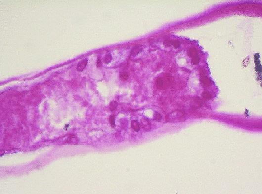 bệnh trên cua, bệnh WSSV trên cua, bệnh virus trên cua bùn