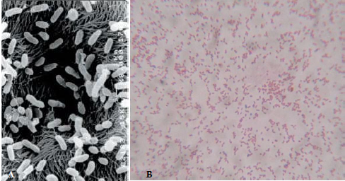 Bacillus subtilis gây bênh đốm trắng do vi khuẩn