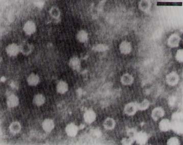 Betaodavirus nuôi cấy từ não cá chẽm bệnh