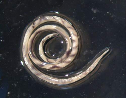 Giun tròn Angiostrongylus cantonensis.