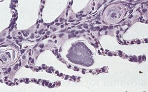 Bệnh Epitheliocystis, Ca. Actinochlamydia pangasiae, loài ký sinh trùng trên cá, ký sinh trùng mới, bệnh của cá tra