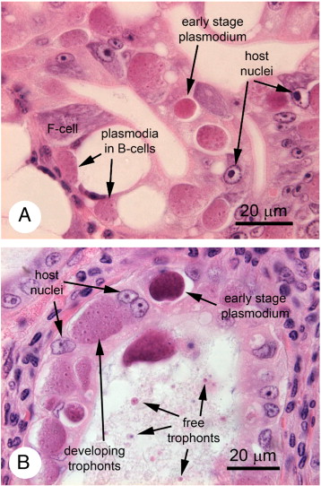 bệnh ký sinh trùng trên tôm, bệnh tôm, ký sinh trùng haplosporidian, haplosporidian trên tôm