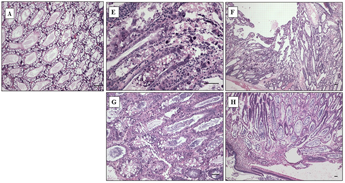 mô bệnh học vibrio campbellii