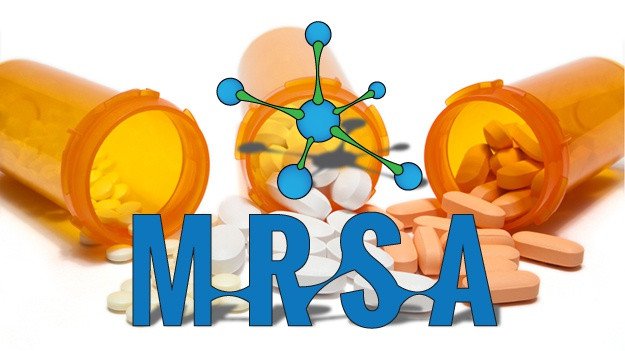 Siêu vi khuẩn MRSA.