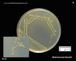 Enterococcus faecalis, vi khuẩn gây chết cá, vi khuẩn Enterococcus faecalis