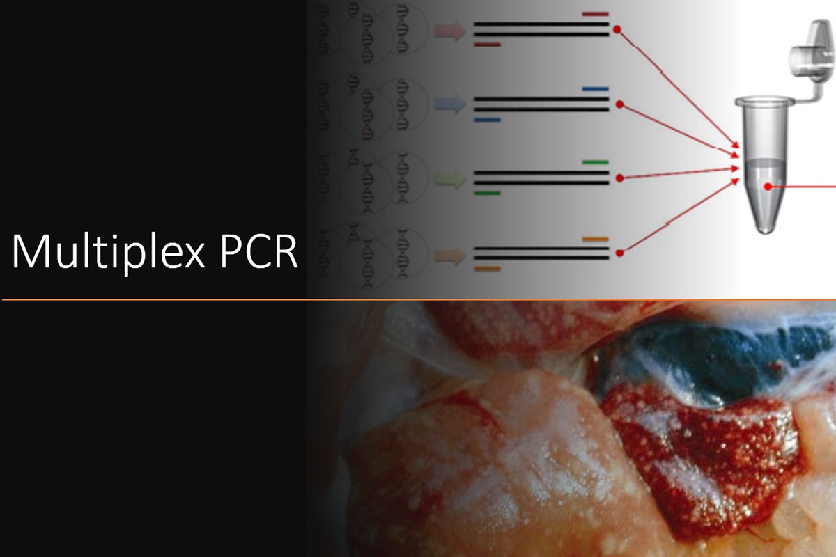 Multiplex PCR gan thận mủ