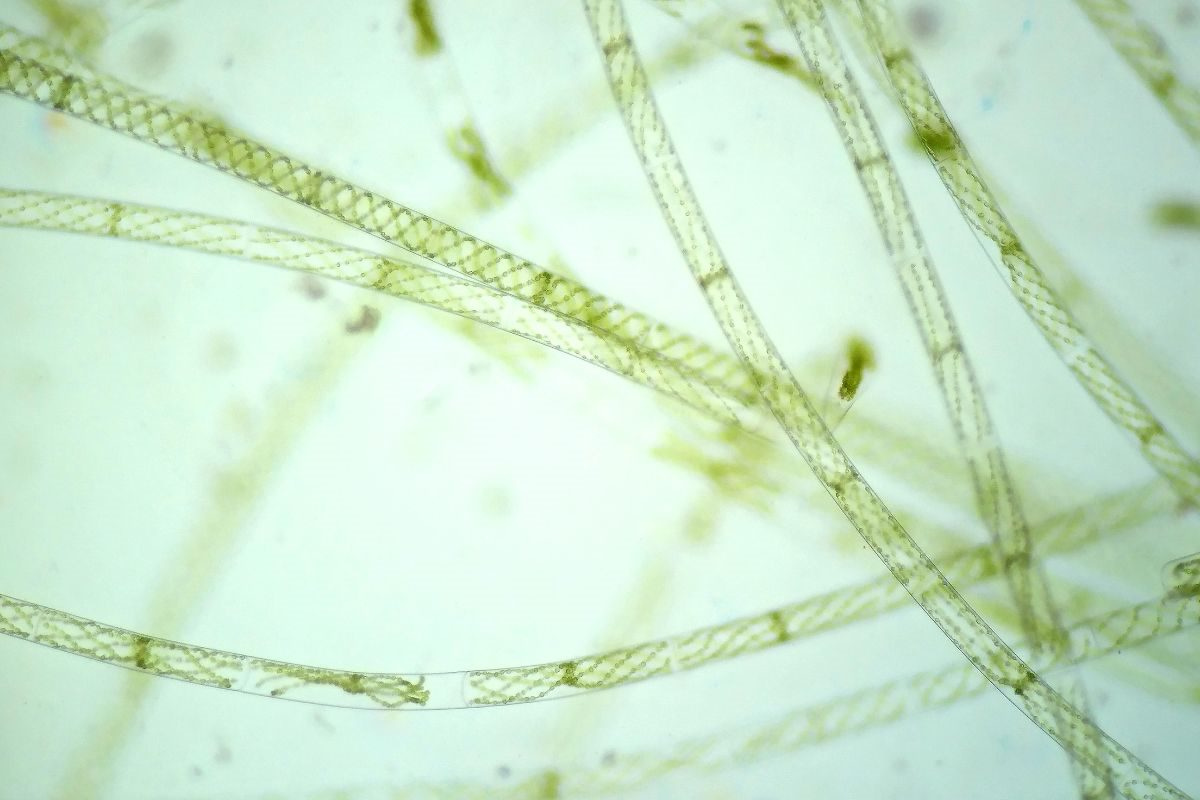 Tế bào tảo sợi