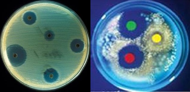 vi khuẩn Staphylococcus aureus