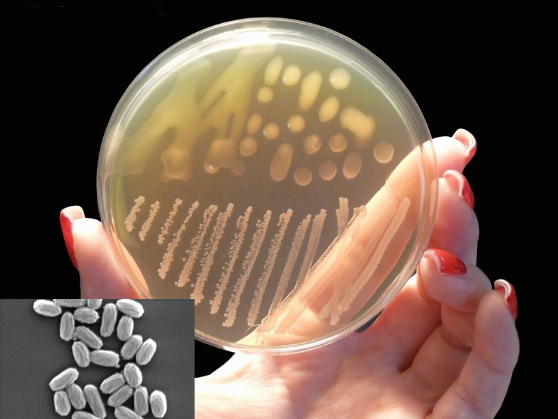probiotics đối kháng với Streptococcus agalactiae