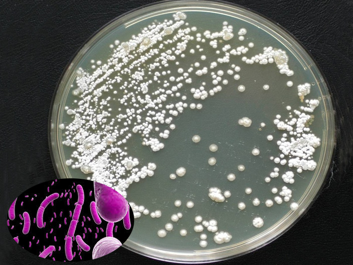 Streptomyces spp - probiotic tuyệt vời cho tôm