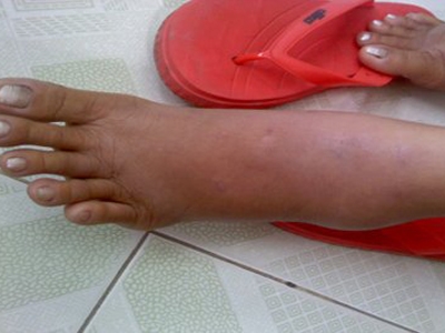 chan bị giuan do an thuy sân chua chin