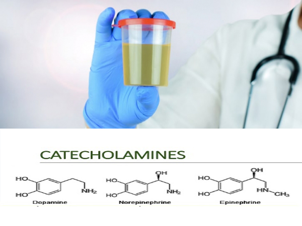 Tác động của catecholamine với tính độc hại của Vibrio Parahaemolyticus