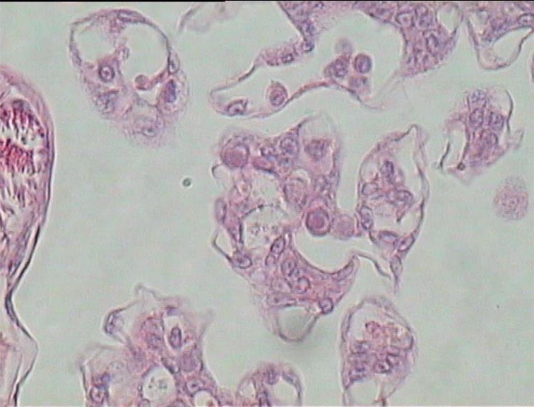 kết quả xét nghiệm bệnh đốm trắng