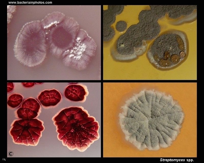 streptomyces sp