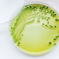 Mỹ thu hồi tôm trên diện rộng vì nguy cơ nhiễm khuẩn Vibrio