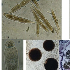 Ký sinh trùng gregarine: Nguyên nhân gây bệnh phân trắng và tôm chậm lớn